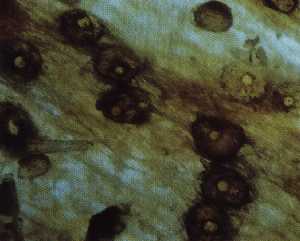 茎部病斑上のつる枯病菌の蛸壺状柄子殻