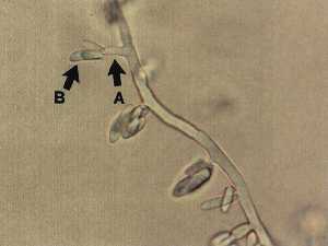 つる割病菌の担子梗と小型分生胞子