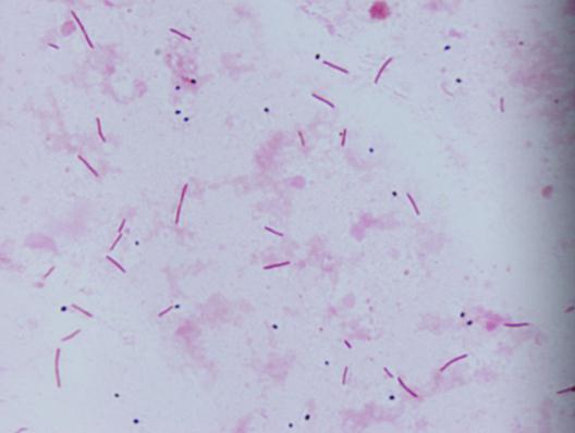 冷水病の原因菌の顕微鏡写真です