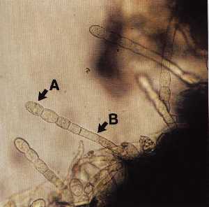 うどんこ病菌の顕微鏡写真