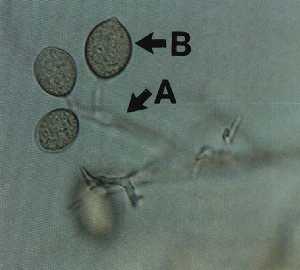 べと病菌の顕微鏡写真