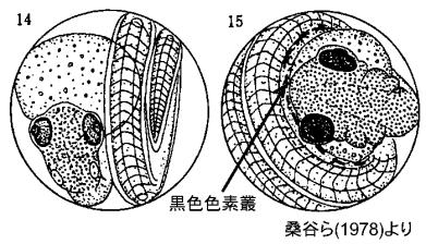 黒色色素叢