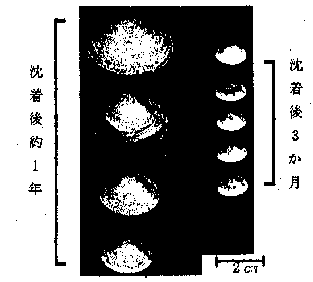 ホッキガイの沈着